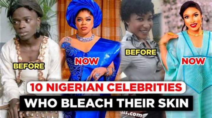Celebrities That Bleach Their Skin Transformative Choices