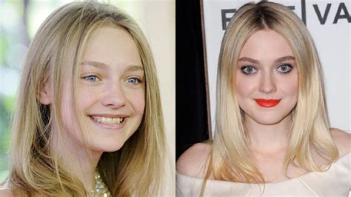 Dakota Fanning Plastic Surgery Before and After