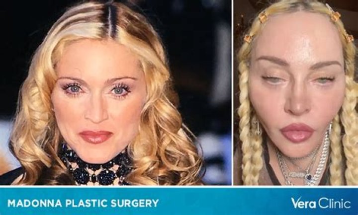 Fran Dreschers Plastic Surgery: Her Transformation Examined!
