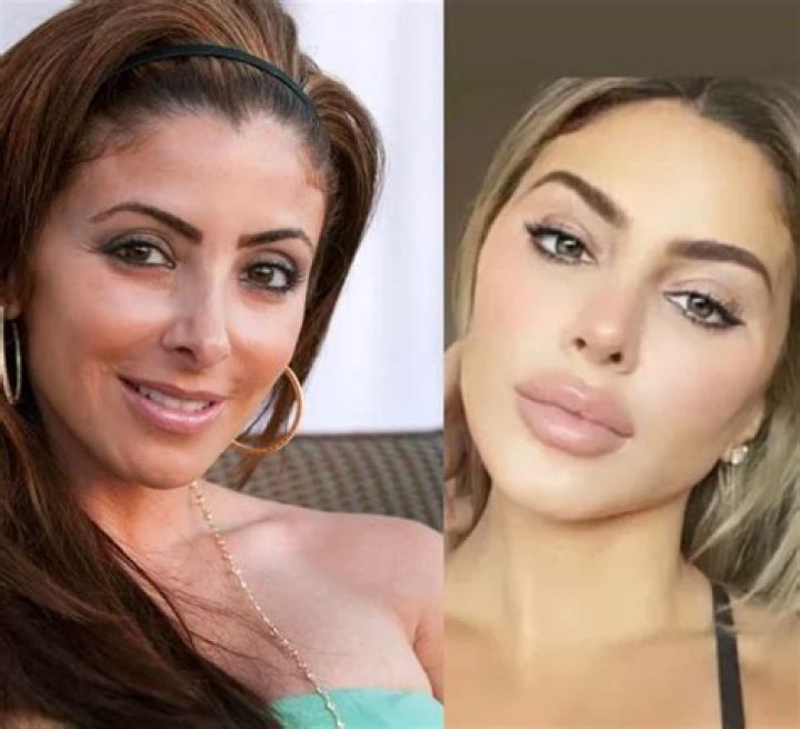 Larsa Pippen Plastic Surgery Before And After Pictures