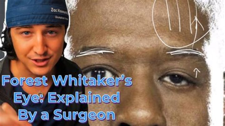 Unlocking The Truth Behind Forest Whitaker's Eye